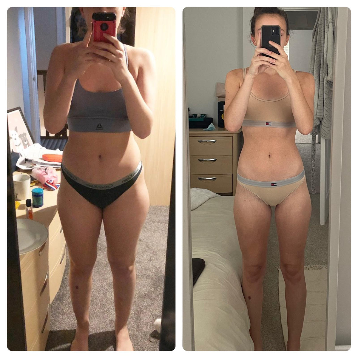 Becca R. before and after